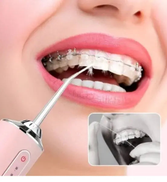 Irrigador Dental